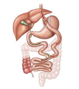 Ilustração de como fica o sistema digestivo com utilização do Bypass gástrico em Y de Roux, um tipo de cirurgia bariátrica