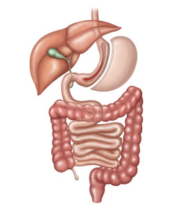 Ilustração do sistema digestivo após Gastrectomia Vertical (Sleeve), um tipo de cirurgia bariátrica.